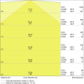 LED-Balkenleuchte-1500mm-3000K-49W-6400lm-IP20-110-IK08-130lmW